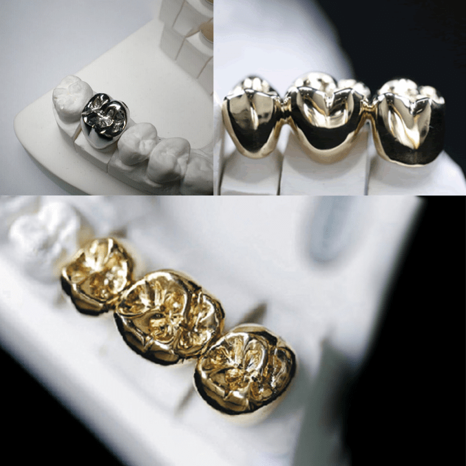 本物の歯のような新しい義歯は磁器の歯に取って代わることが期待されています