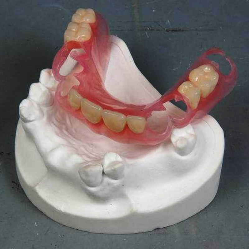 ヴァルプラスト部分床義歯