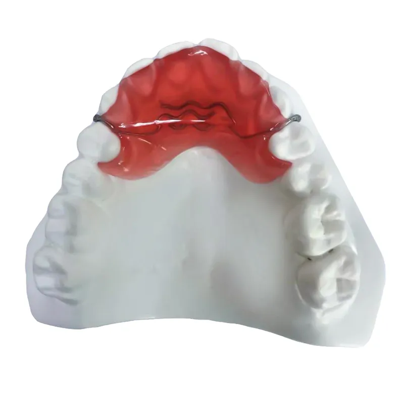 Anterior Bite Plane