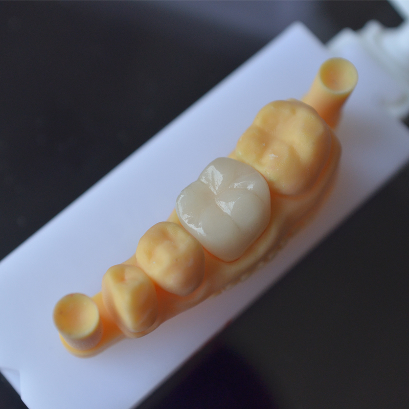 3D Printing Of Dentures
