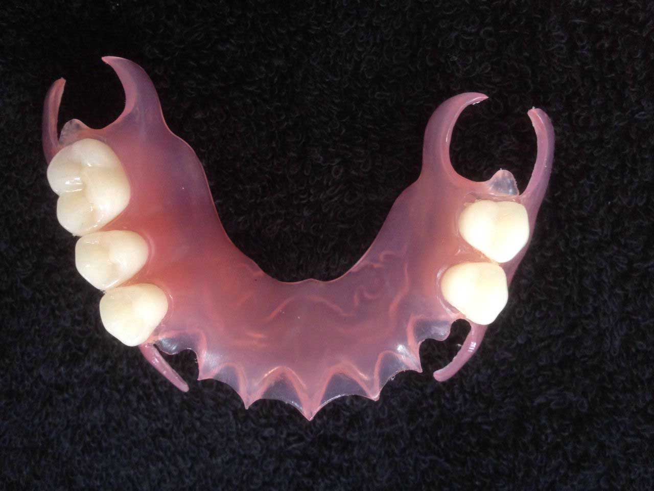 Partial Denture  Dental Acrylic Teeth in Dentistry Quick and Easy