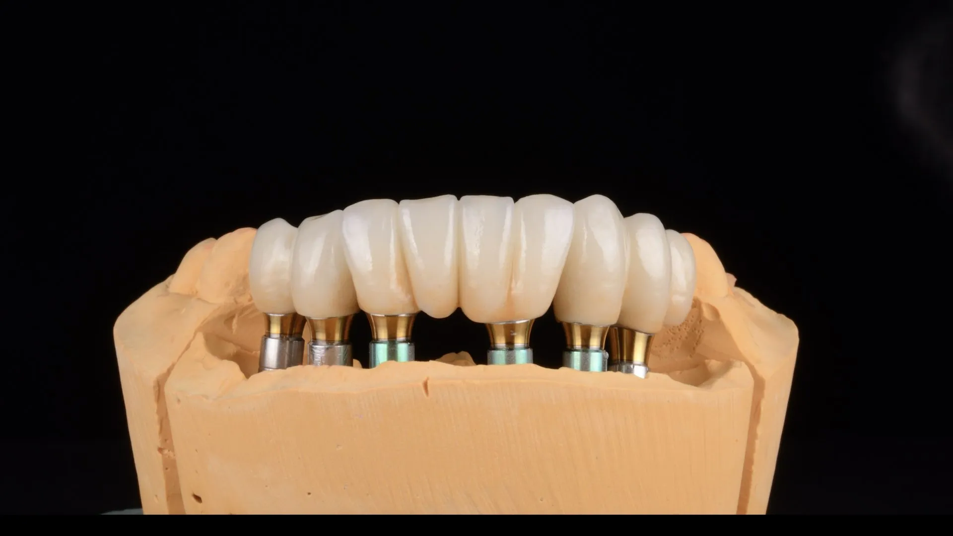 ¿Cómo cuidar los implantes dentales?