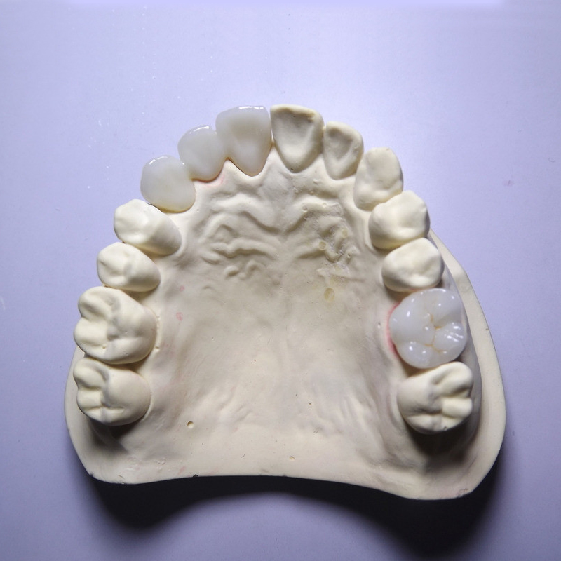 Why the zirconia crown is of high quality