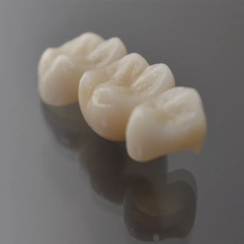 Zirconia Koroaren ezaugarriak