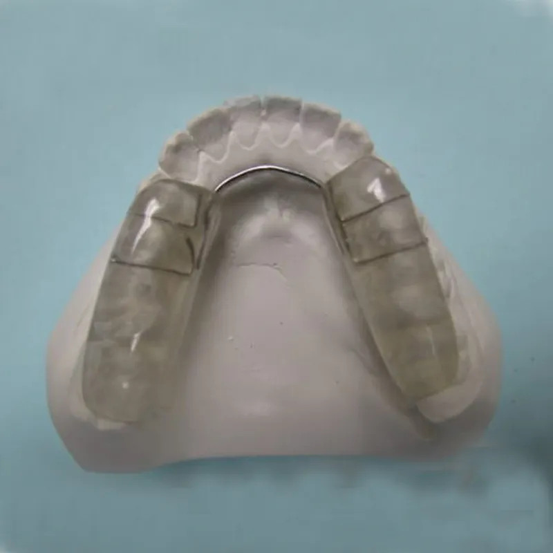 The role of occlusal splints