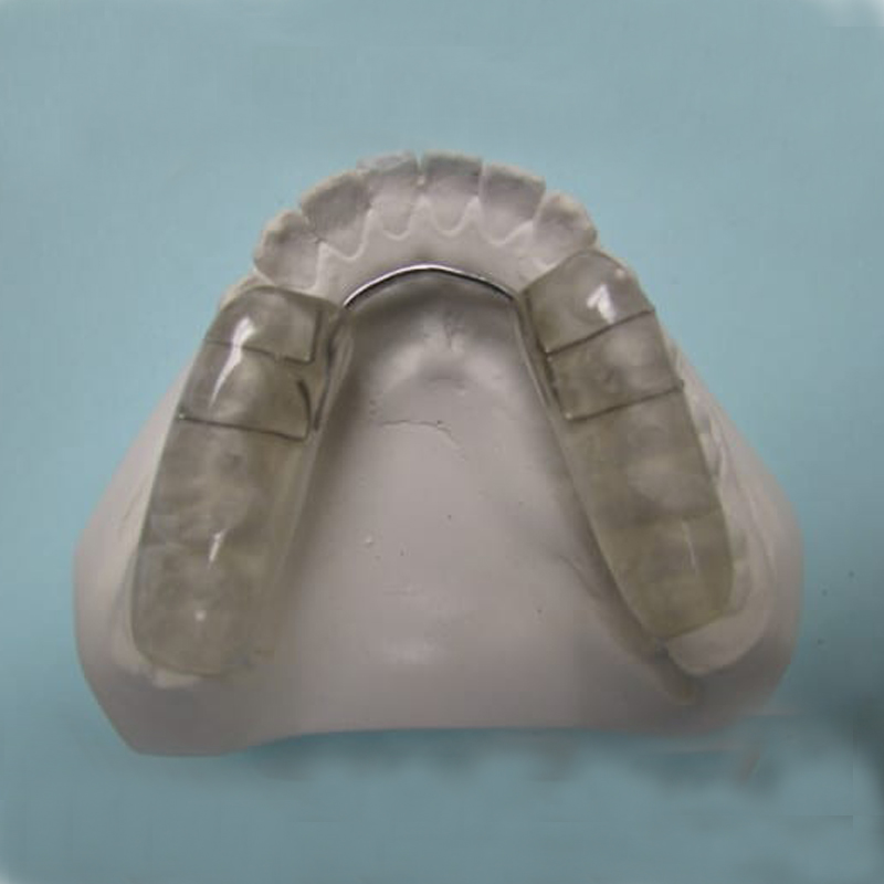 Introduction and indications of stable occlusal splint