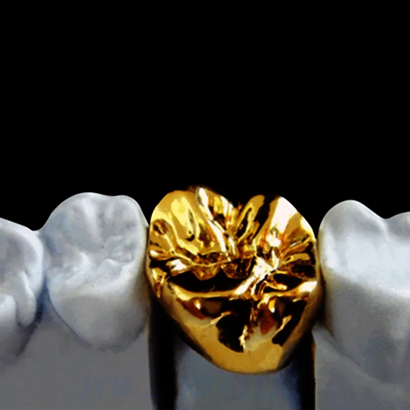 Dientes de porcelana con corona de metal completo.