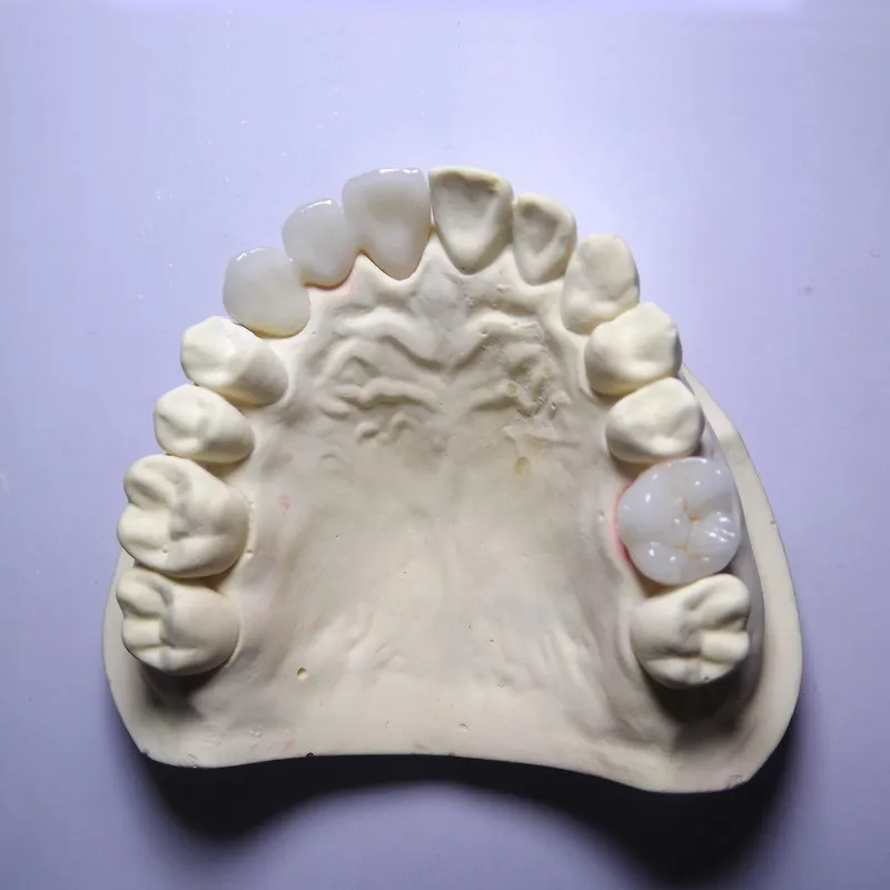 Questi vantaggi della zirconia devono essere conosciuti