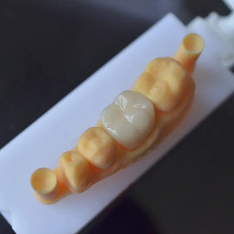 How about 3D printing teeth? Is the technology mature?