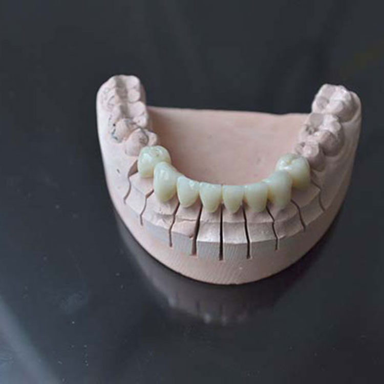What are the advantages of porcelain teeth?