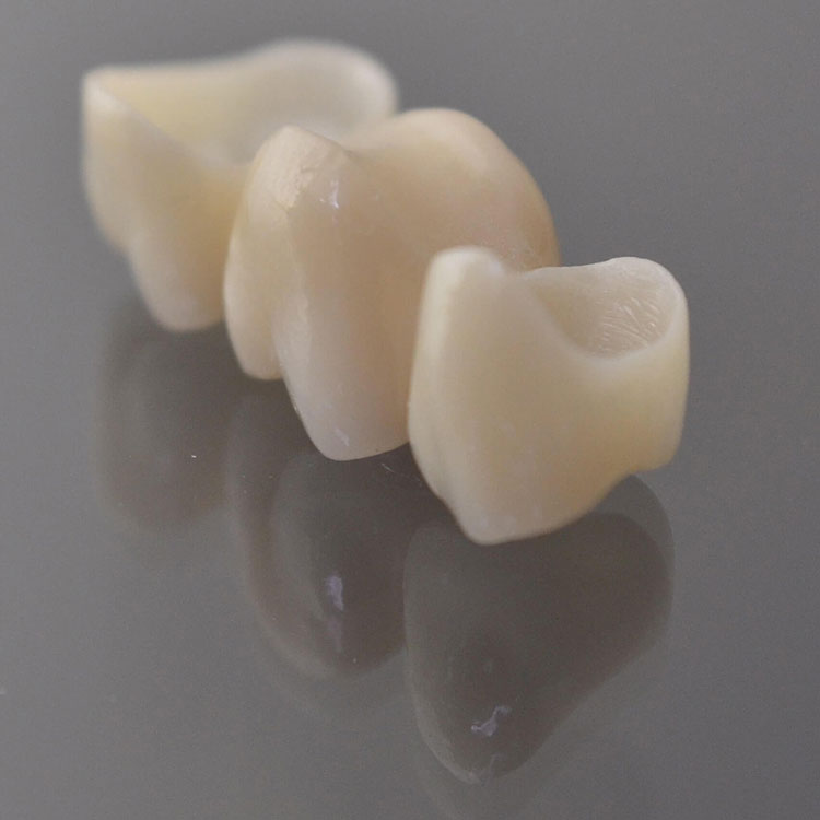 What is a zirconia all-ceramic crown?