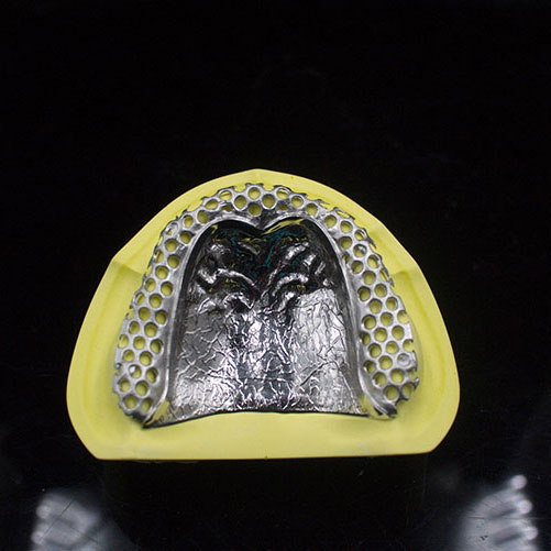 Metal porcelain teeth