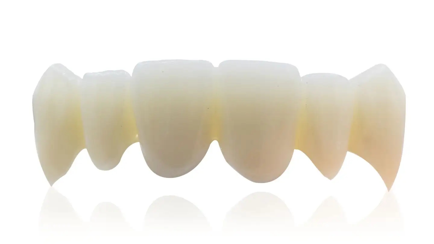 china dental lab explains some popular science about all-ceramic crown restoration