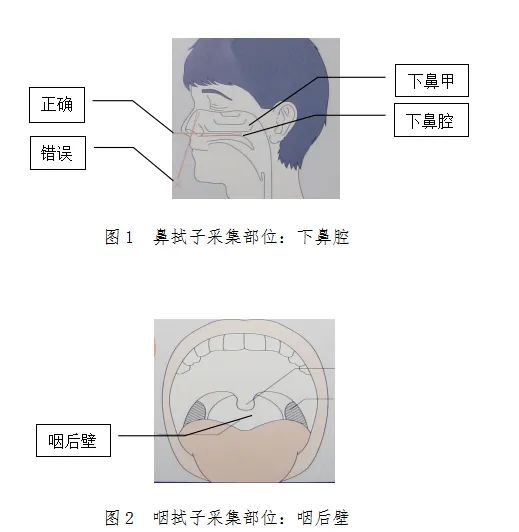 Method for collection of nasopharyngeal swab specimens 