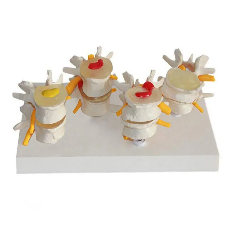 4 Panggung Vertebra Model