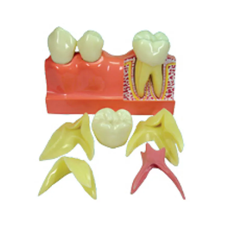 4-maliges Zerlegen des Zahnmodells
