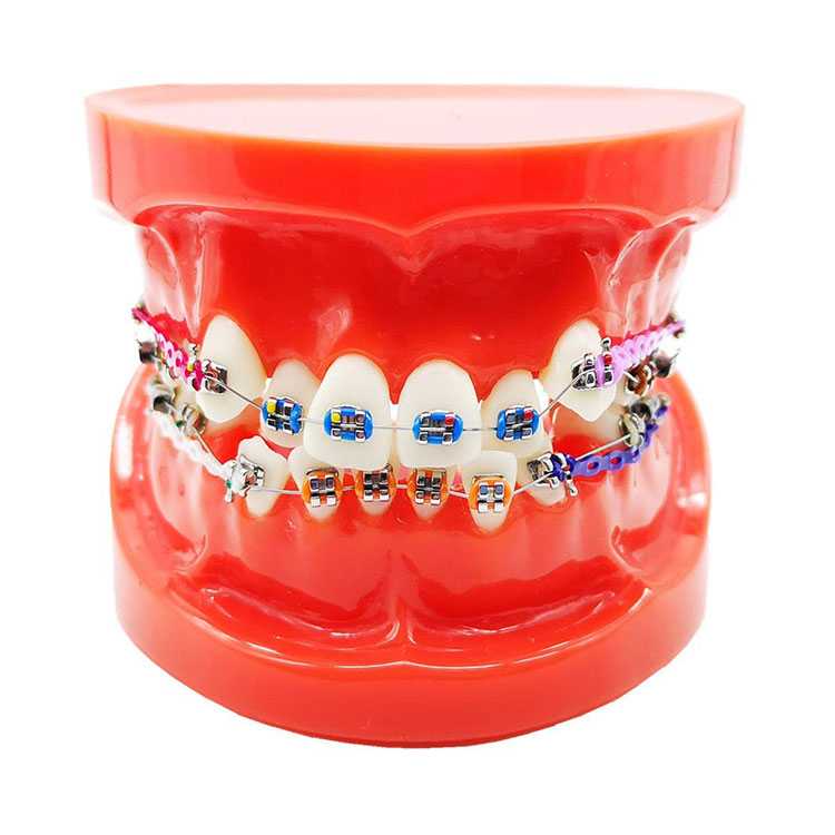 Dental Ortodontik Dişlər Modeli