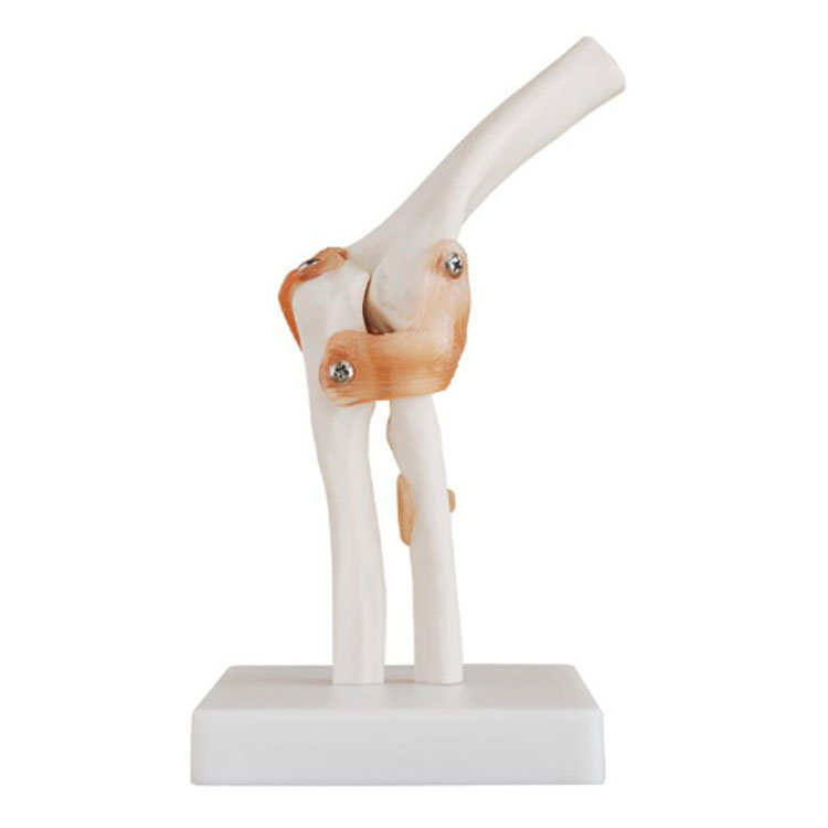 Model lakťového kĺbu