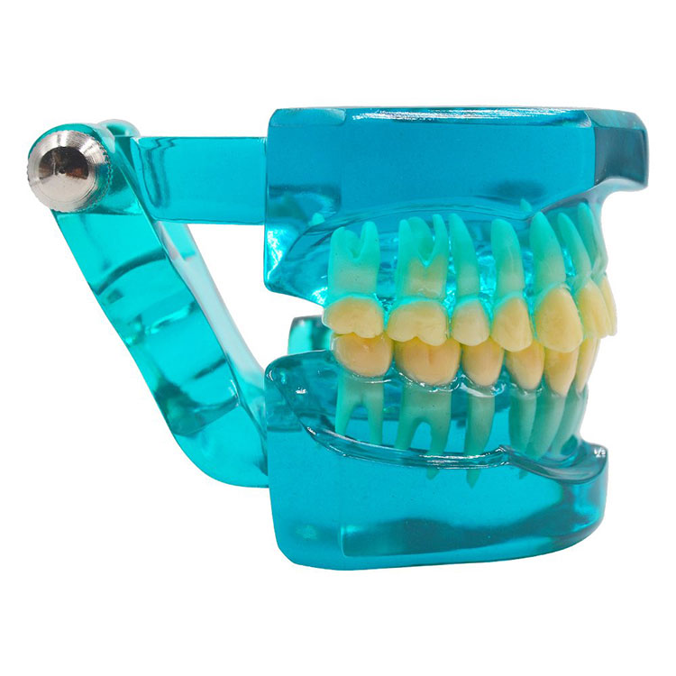 Ортодонтски зубни модел