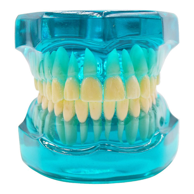 Modelo dental de ortodoncia