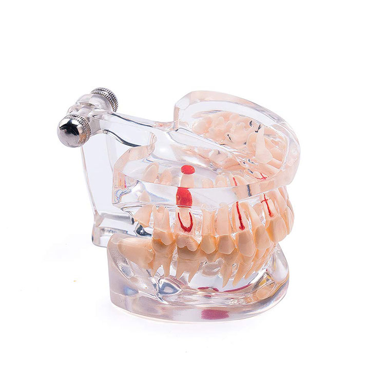 Патолошки модел на заби