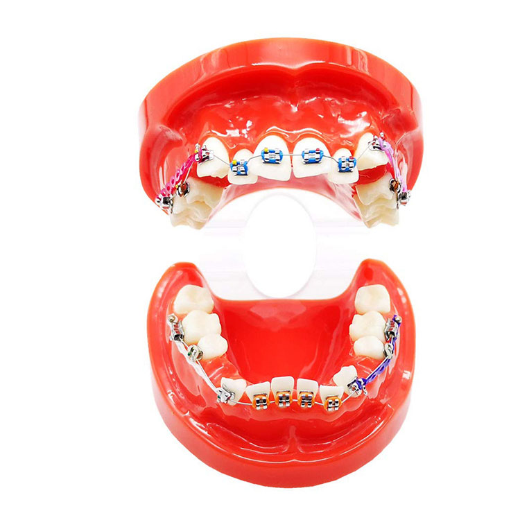 Modelo de dente ortodôntico dentário