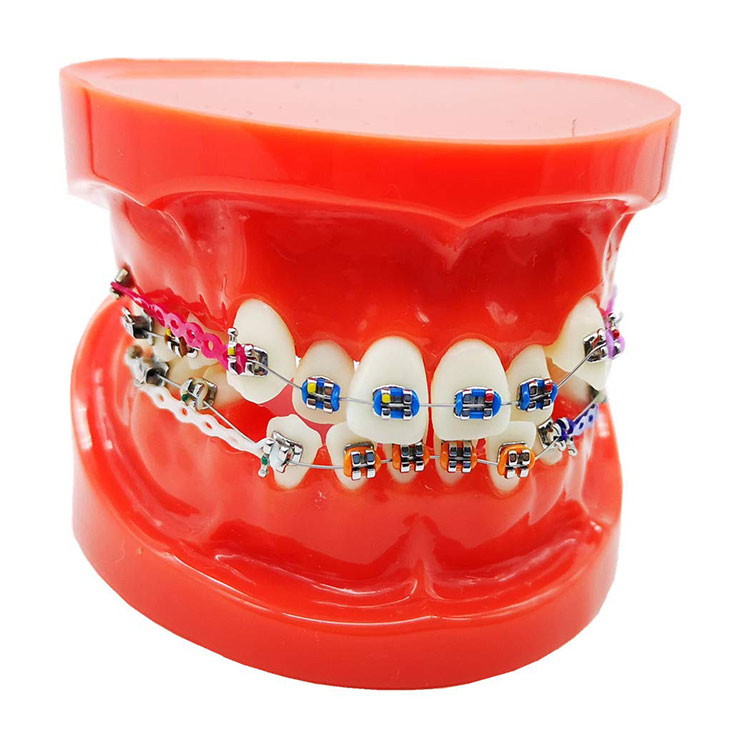 Dantų ortodontinių dantų modelis