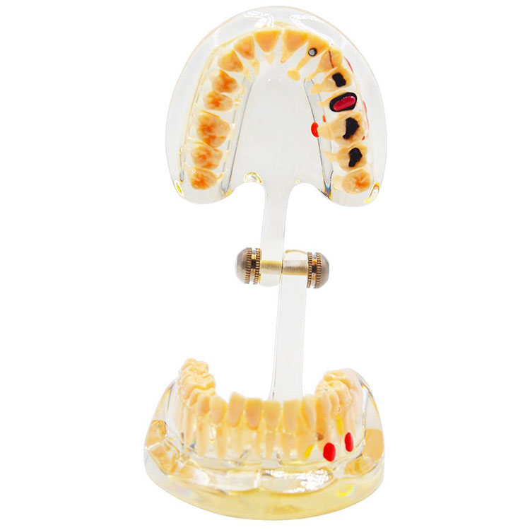 Burnos klinikos skaidrus suaugusių dantų modelis