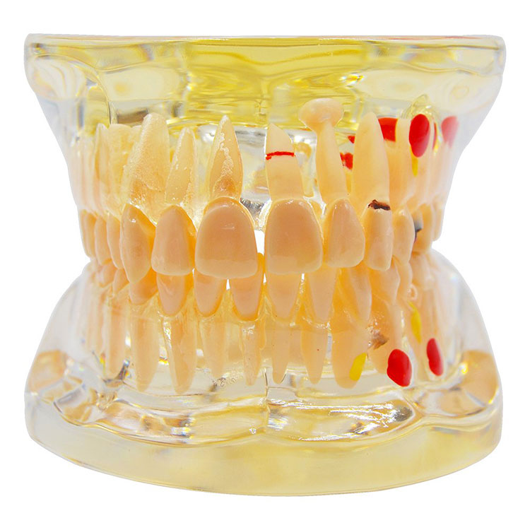 Transparentní model zubů pro dospělé na ústní klinice