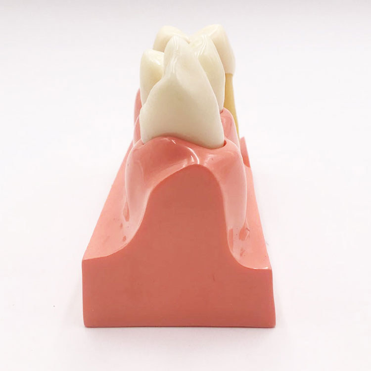4 пати модел за расклопување на забите