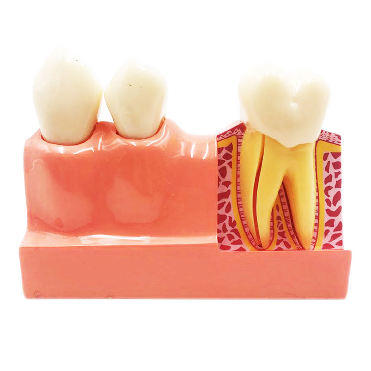 Model de dinți de 4 ori demontat