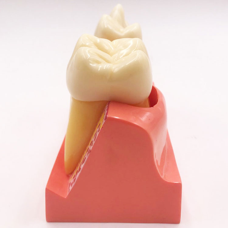 Model de dinți de 4 ori demontat