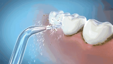 Household Five-mode Dental Water Flosser Of Wopin