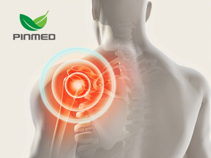 How should shoulder periarthritis relieve?