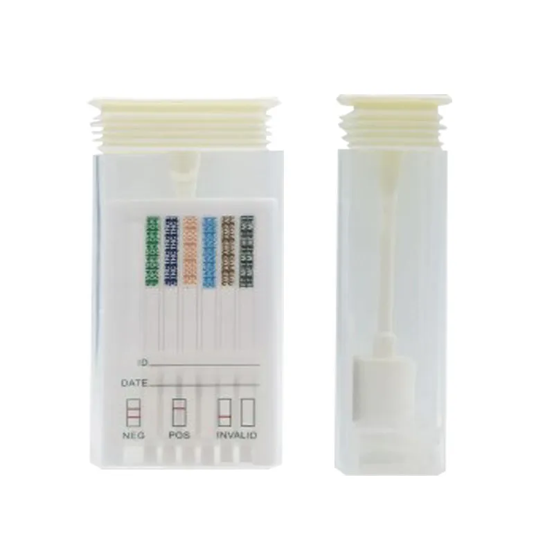 What are the two urine test strips showing?