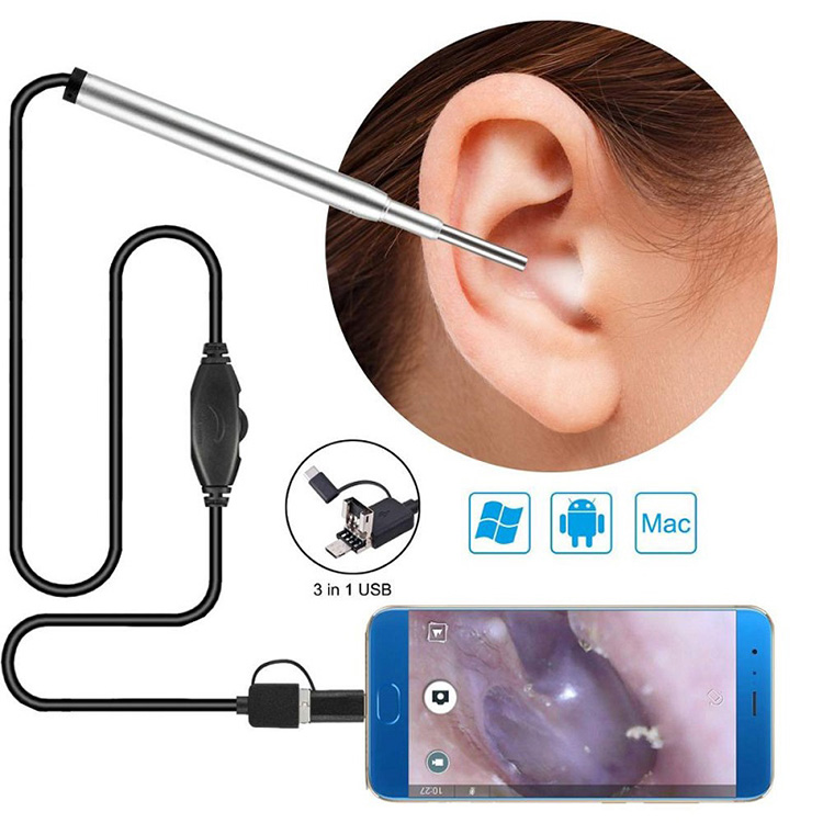 Medikal na Endoscope Camera Ear Nasal Endoscope Usb Otoscope