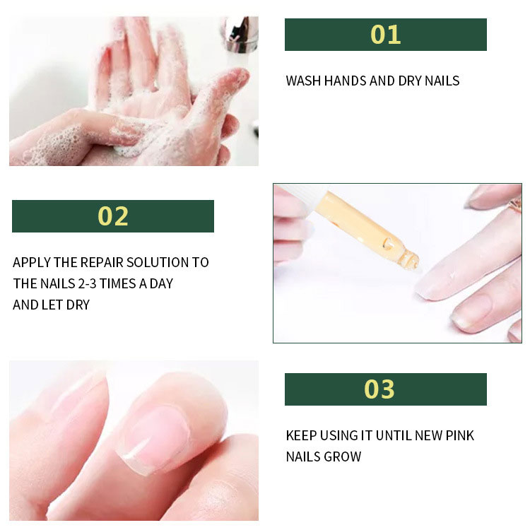 Течност за лечение на гъбички по ноктите