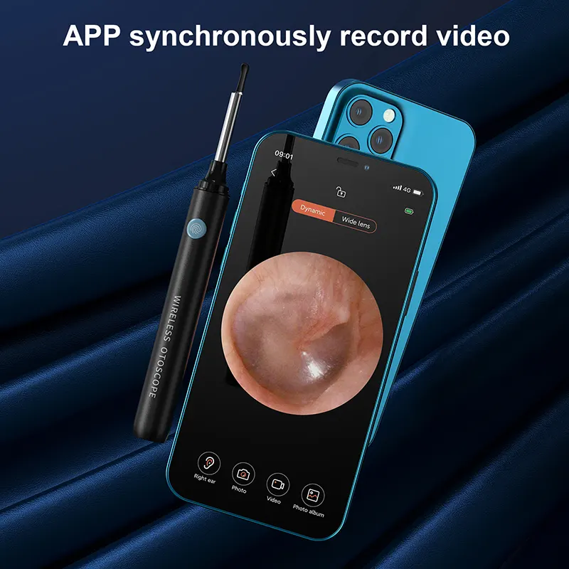 Smart Visual Ear Cleaner With Camera
