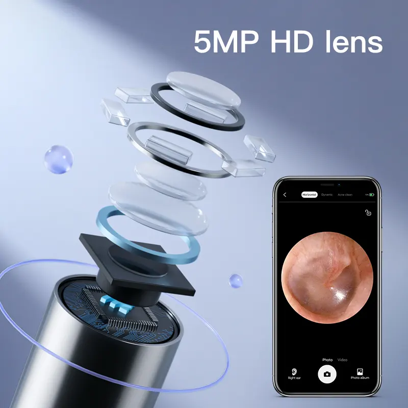 Otoscopio per la pulizia dell'orecchio visivo multifunzione da 5 MP