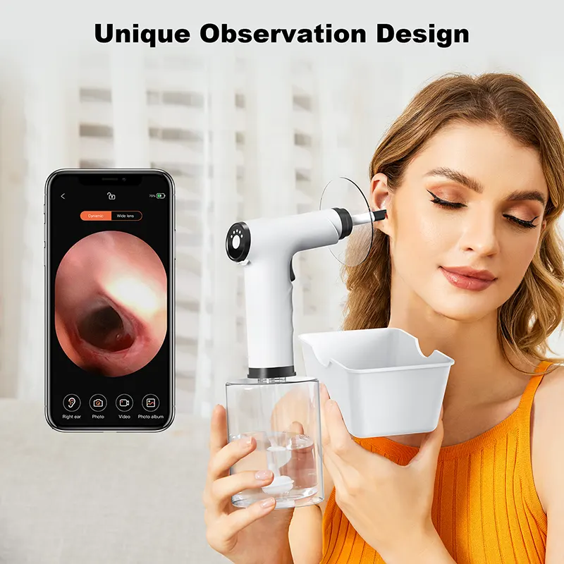 Handheld slimme visuele oorwasmachine