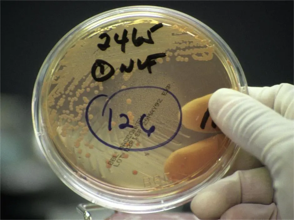 Tại sao đĩa nuôi cấy tế bào cần xử lý bề mặt?