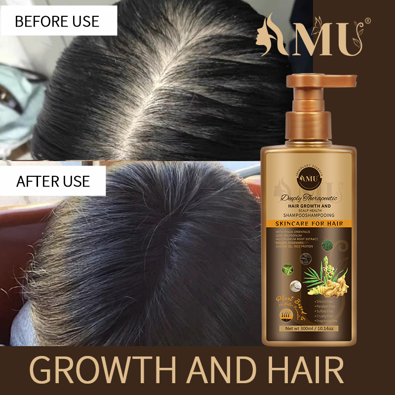 Deeply Therapeutic Hair Growth And Scalp Health Shampoo