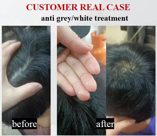 vitt/grått hår blir naturlig hårbehandling