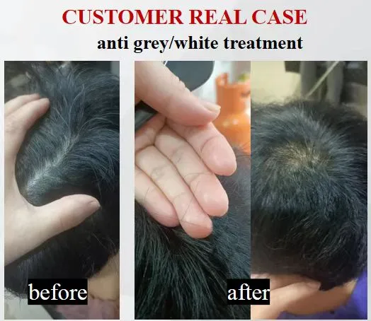 white/grey hair turns natural hair treatment