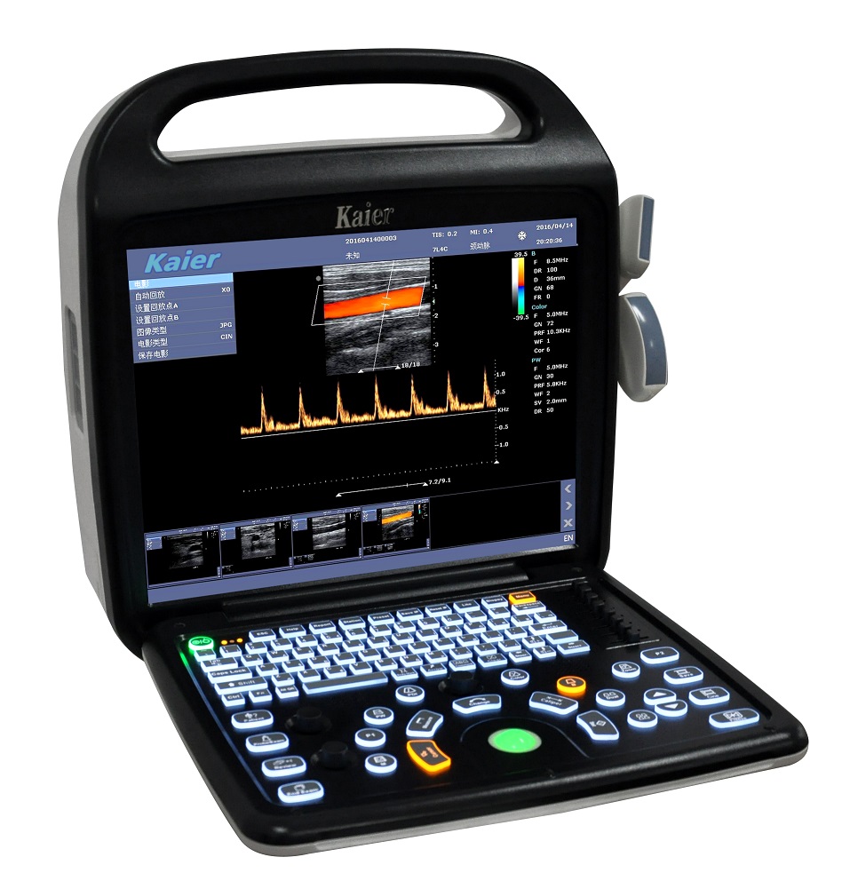 Sistem Pengimejan Ultrasound Doppler Warna