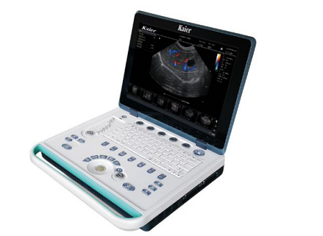 E80 színes Doppler állatorvosi ultrahang diagnosztikai rendszer