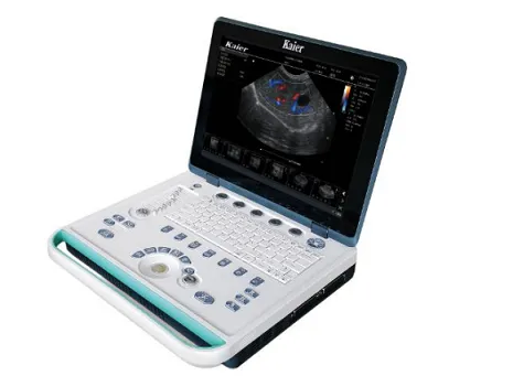 Sistem Diagnostik Ultrabunyi Veterinar E80 Color Doppler