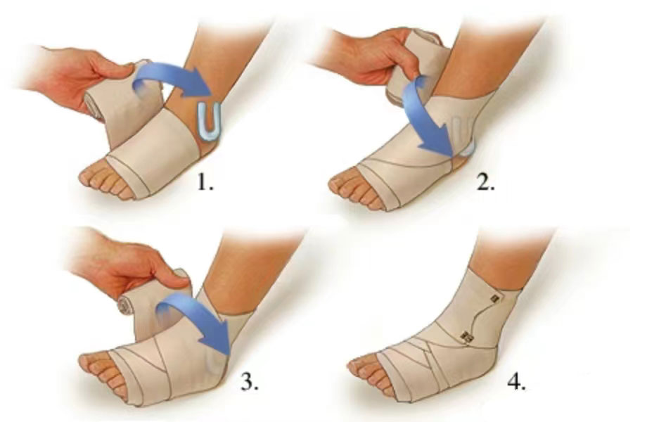 Foot Injury First Aid Guide