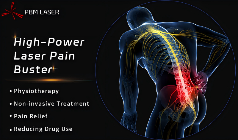 PBM Medical Laser 丨 Unlocking the Rehabilitation Code, High-Power Laser Receives Grade A Recommendation in China's Chronic Low Back Pain Diagnosis and Treatment Guidelines (2024 Edition)