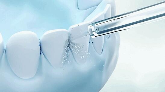Water Flosser: The Modern Weapon for Oral Care